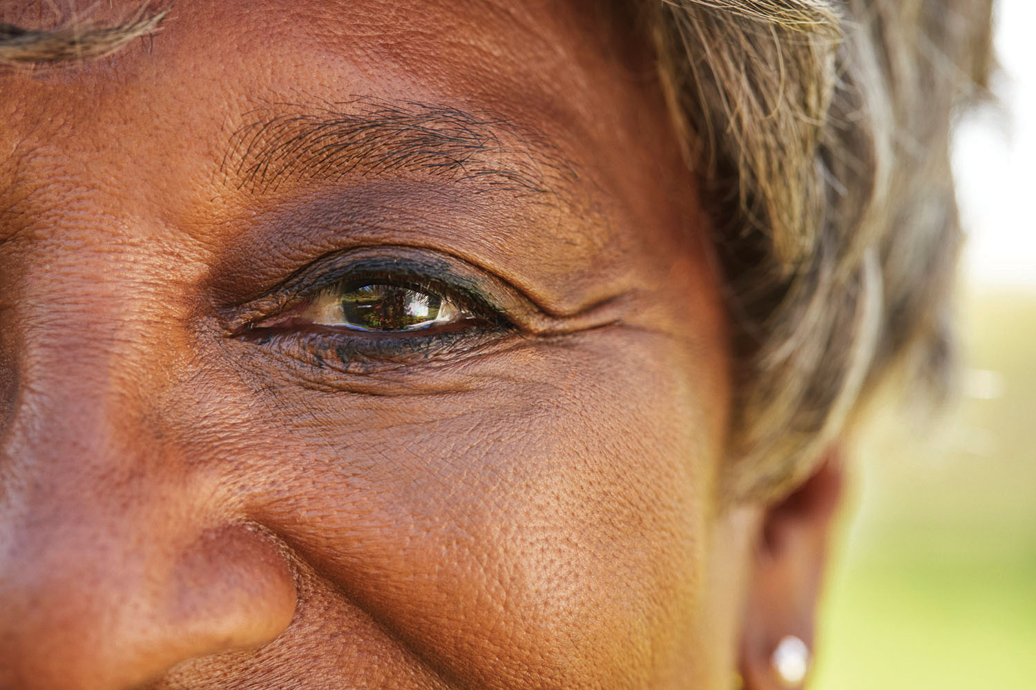 Macular degeneration