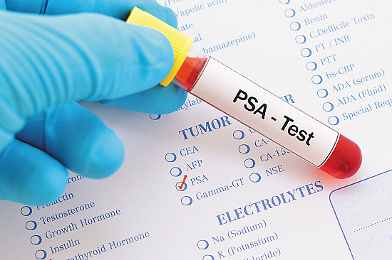 Should I continue to get regular PSA testing after age 70? featured image