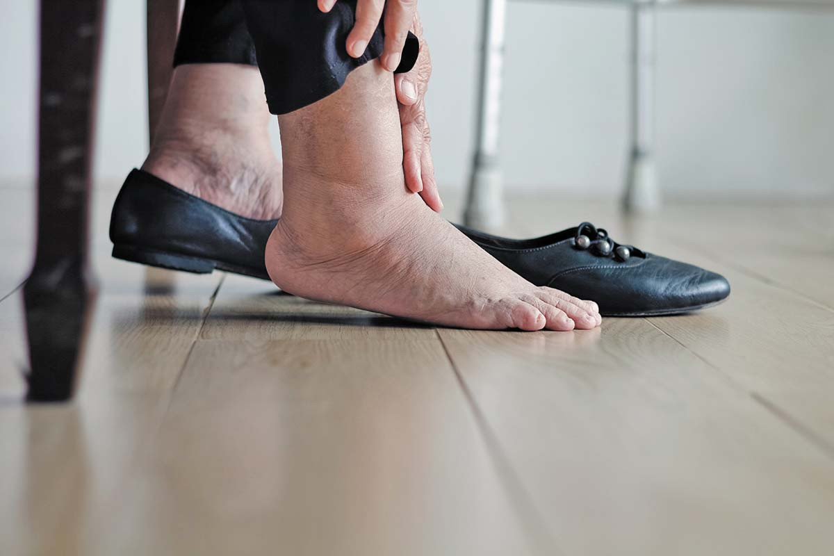cropped photo showing the feet and lower legs of a person with swollen ankles rubbing one of them