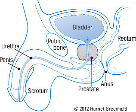 Acute prostatitis featured image