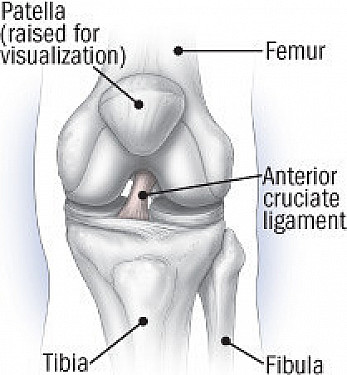 Anterior cruciate ligament (ACL) injuries featured image