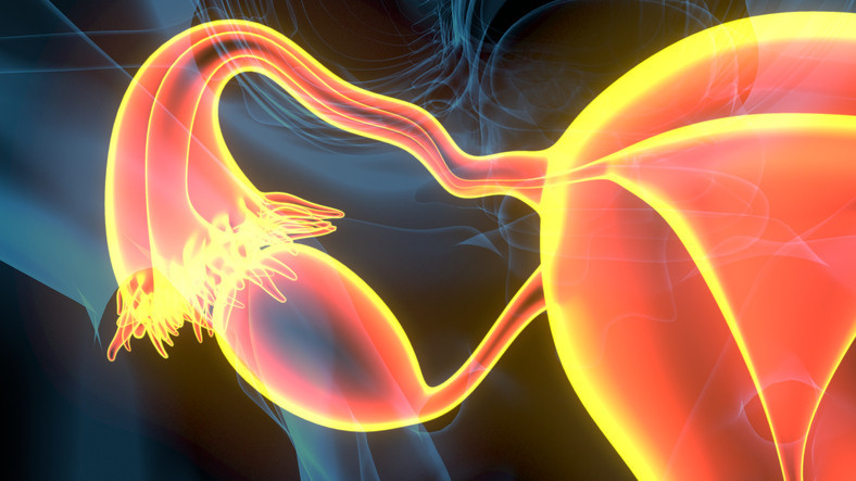 Preventing ovarian cancer: Should women consider removing fallopian tubes?