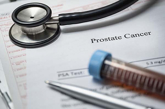 New research shows little risk of infection from prostate biopsies featured image