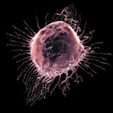For early breast cancer, lumpectomy is at least as good as mastectomy featured image