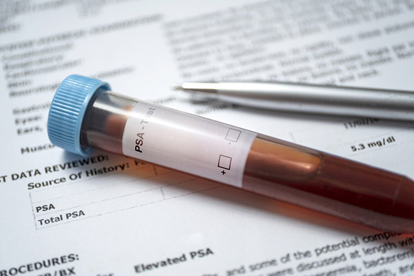 FDA approves new treatment for advanced prostate cancer