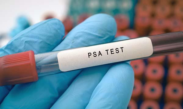 Gloved hand holding a vial of blood with the label PSA test; a rack of other tubes is out of focus below the hand.