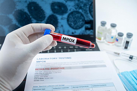 Mpox is back: What to know and do featured image