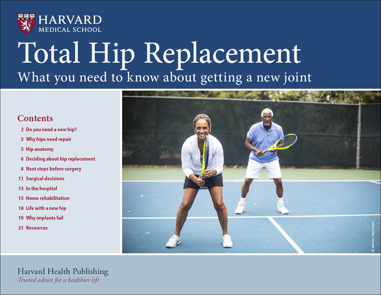 Total Hip Replacement: What you need to know about getting a new joint
