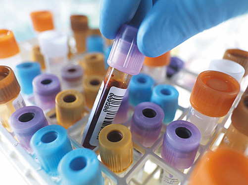 New thinking on important blood tests featured image