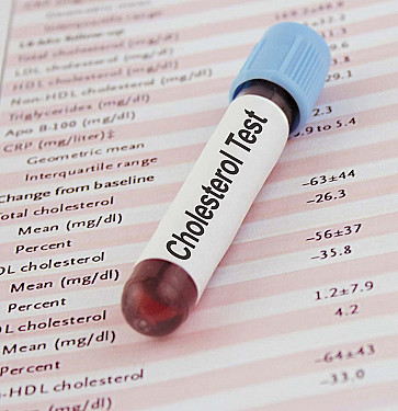 Can I lower my cholesterol without a statin? featured image