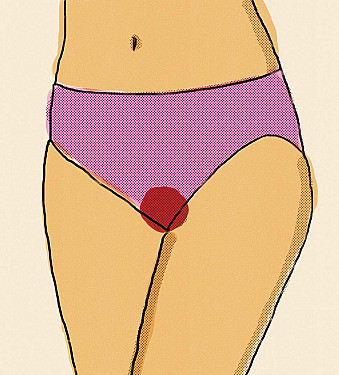 Can periods restart after menopause? featured image