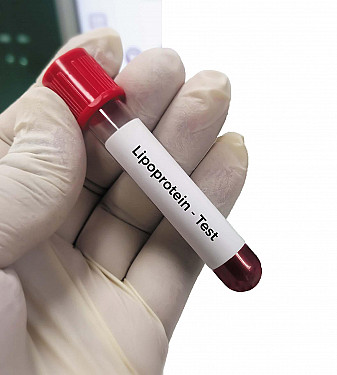Lipoprotein(a): An update on testing and treatment featured image
