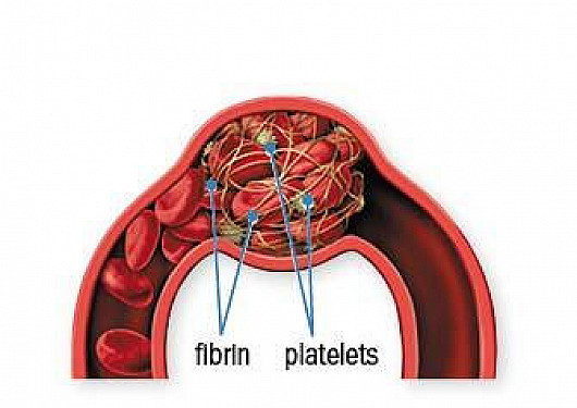 What’s new in blood clot prevention? featured image