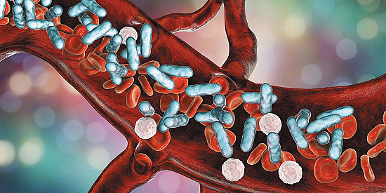 Stopping sepsis in its tracks featured image