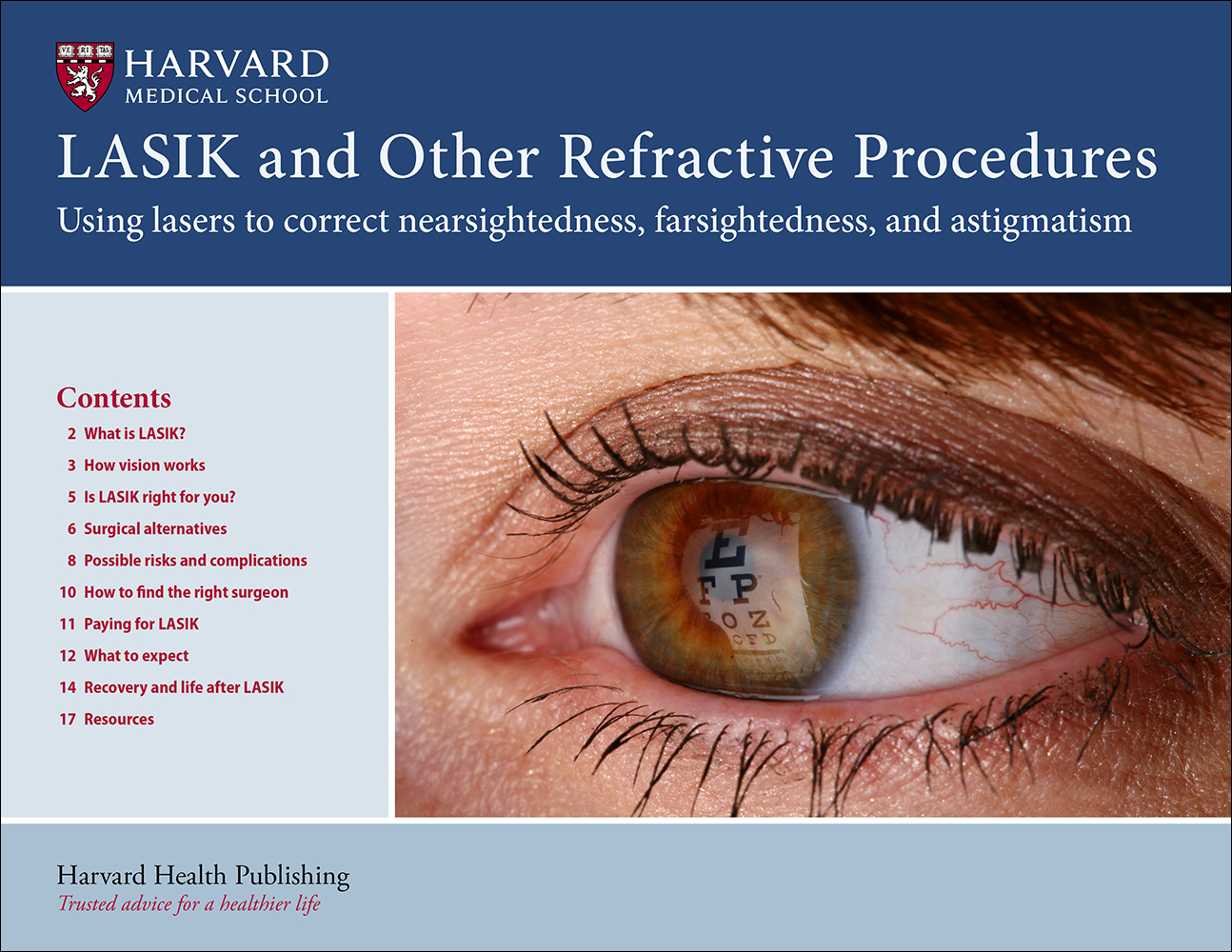 LASIK and Other Refractive Procedures: Using lasers to correct nearsightedness, farsightedness, and astigmatism
